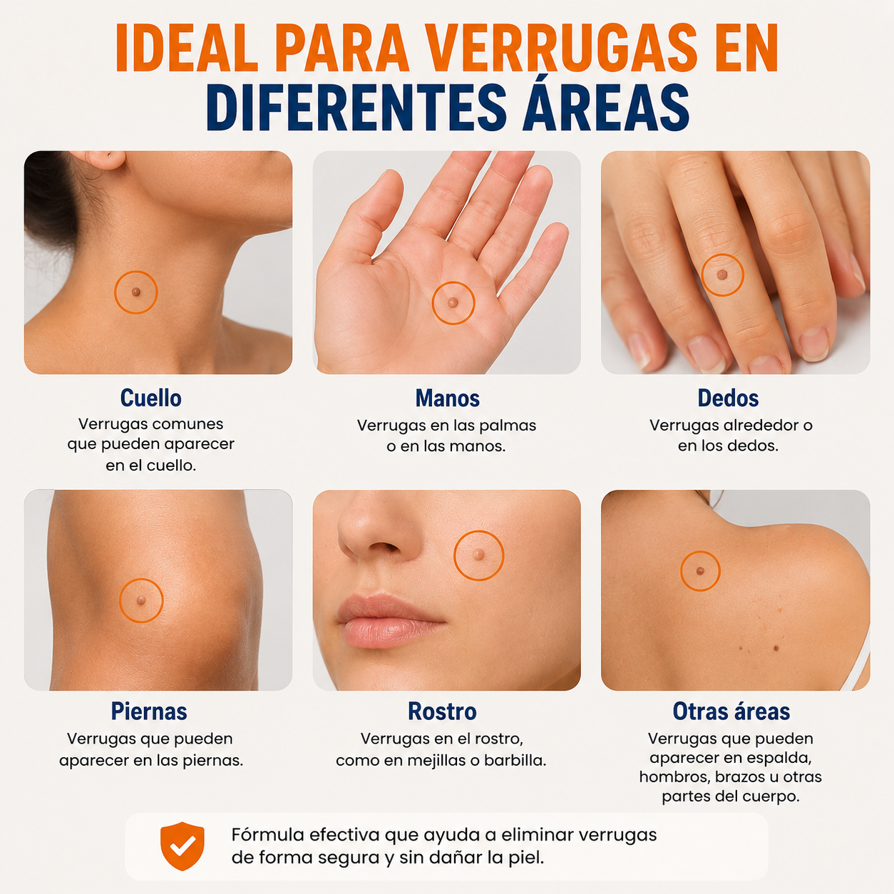 Crema Anti Verrugas Dermatológica | Elimina Verrugas de Forma Rápida y Segura